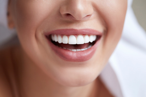 Image of a woman smile close up near Riverwind Dental.
