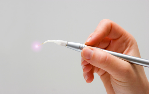 Close up of dentist holding tool for laser gum treatment at Riverwind Dental in Henrico, VA