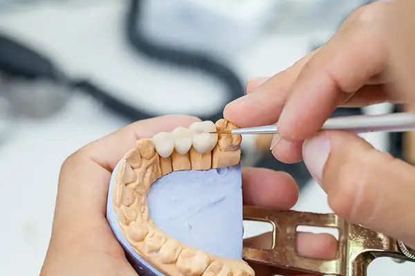 A dental technician completing precise finishing touches on a dental bridge at Riverwind Dental in Henrico, VA