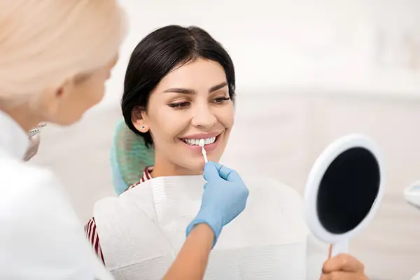 dental veneers 3