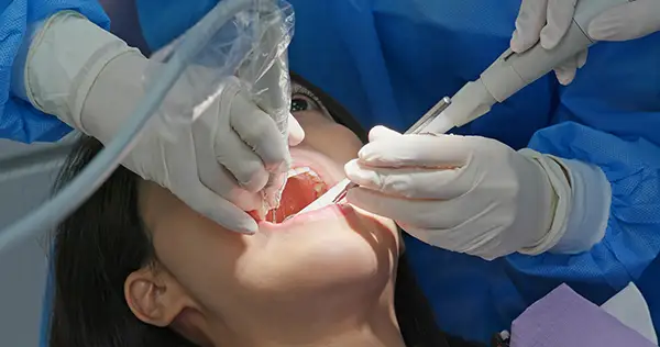 Dentist performing a root canal treatment on a patient at Riverwind Dental in Henrico, VA Dentist performing a root canal treatment on a patient at Riverwind Dental in Henrico, VA
